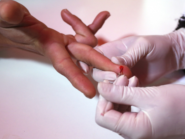 Se intensificar&aacute;n acciones preventivas por infecci&oacute;n de VIH el 2019